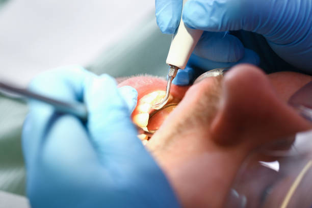 Best Mobile Emergency Dentist in Commerce, GA