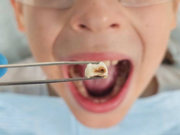 Best Emergency Cosmetic Dentistry in Commerce, GA